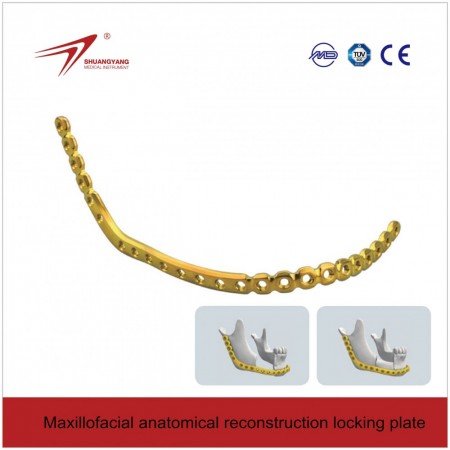 locking maxilofacial rekonstruction anatomiqal plate.ქვედა ყბის რეკონსტრუქციული ფირფიტა